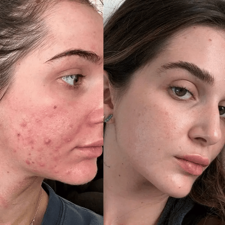 7-IN-1 LED Facial Therapy Sculptor