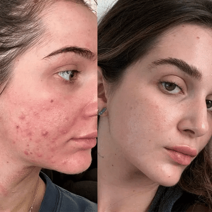 7-IN-1 LED Facial Therapy Sculptor